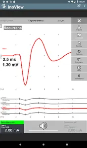 inoView screenshot 6