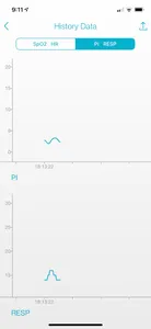 iOX - Smart Phone Pulse Oximet screenshot 3