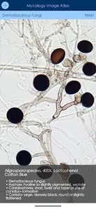 Mycology Image Atlas screenshot 1