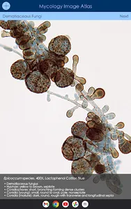 Mycology Image Atlas screenshot 13