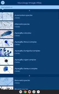 Mycology Image Atlas screenshot 14