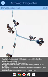 Mycology Image Atlas screenshot 7