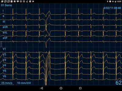 CardioFlex ECG screenshot 11