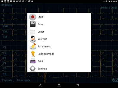CardioFlex ECG screenshot 13