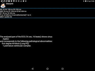 CardioFlex ECG screenshot 14