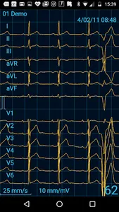CardioFlex ECG screenshot 3