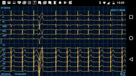 CardioFlex ECG screenshot 4