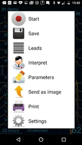 CardioFlex ECG screenshot 7