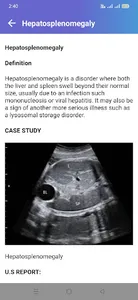 Abdominal Ultrasound Guide screenshot 2