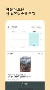 에브리톡톡 - AI 탈모점검 사진으로 탈모 분석 screenshot 1
