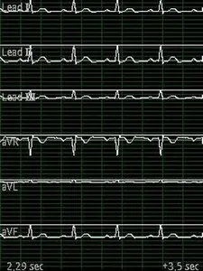 EDF Viewer screenshot 0