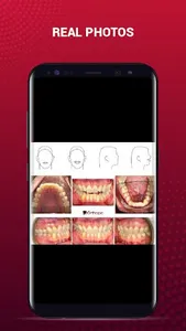 OrthoPic: HD Dental Images screenshot 6