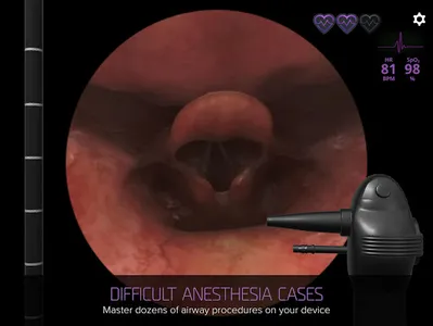 Airway Ex: Anesthesiology Game screenshot 16