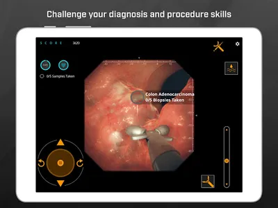 Gastro Ex: Played by Gastroent screenshot 10