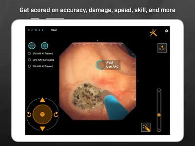 Gastro Ex: Played by Gastroent screenshot 6