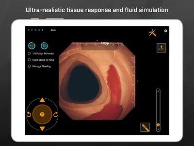 Gastro Ex: Played by Gastroent screenshot 9