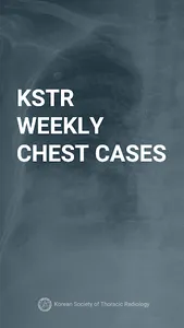 KSTR Weekly Chest Cases screenshot 0