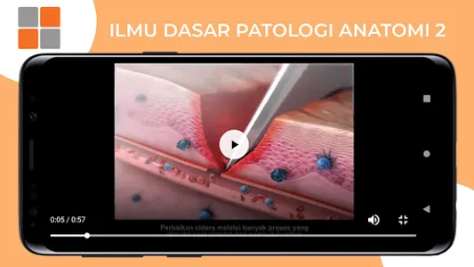 M3 Gizi: Ilmu Dasar Patologi A screenshot 7