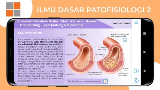 M3 Kesehatan: Ilmu Dasar Patof screenshot 20