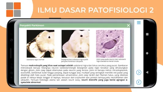M3 Kesehatan: Ilmu Dasar Patof screenshot 5