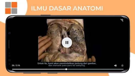 M3 Kesmas: Ilmu Dasar Anatomi  screenshot 20