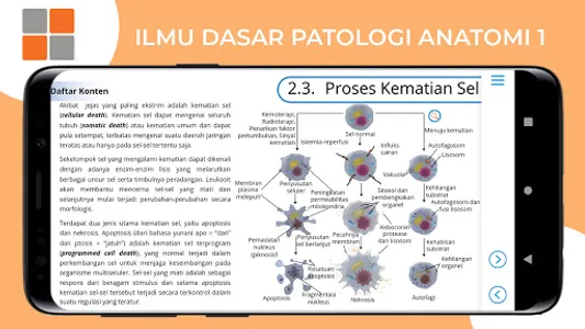 M3 Kesmas: Ilmu Dasar Patologi screenshot 12