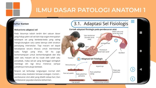 M3 Kesmas: Ilmu Dasar Patologi screenshot 14