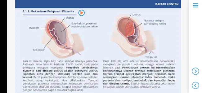 M3 Kebidanan: Asuhan Persalina screenshot 13