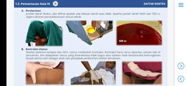 M3 Kebidanan: Asuhan Persalina screenshot 14