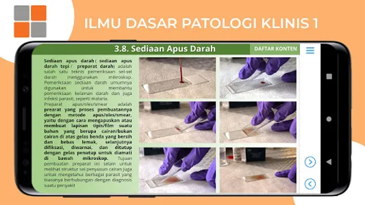 M3 TLM: Ilmu Dasar Patologi Kl screenshot 22
