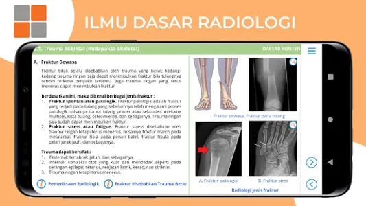 M3 TLM: Ilmu Dasar Radiologi screenshot 12