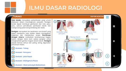M3 TLM: Ilmu Dasar Radiologi screenshot 5