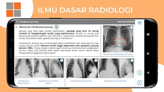 M3 TLM: Ilmu Dasar Radiologi screenshot 6