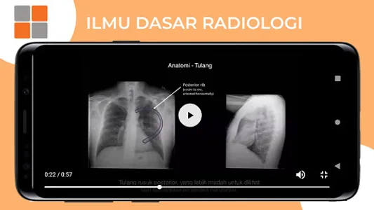 M3 TLM: Ilmu Dasar Radiologi screenshot 7