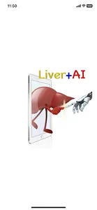 Liver+AI screenshot 2
