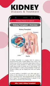 Kidney Diseases and Treatment screenshot 4