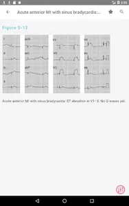 Swanton's Cardiology Guide screenshot 10