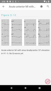 Swanton's Cardiology Guide screenshot 3