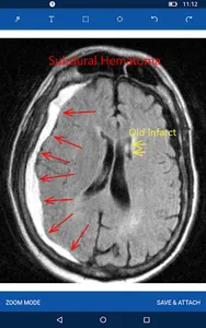 MedSynger screenshot 2