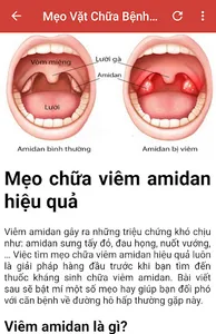 Mẹo Vặt Chữa Bệnh Từ A Đến Z screenshot 10