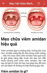 Mẹo Vặt Chữa Bệnh Từ A Đến Z screenshot 2