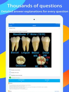 NBDE I Expert:Dental Board screenshot 9