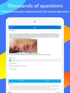 USMLE Step 2 Exam Expert screenshot 9