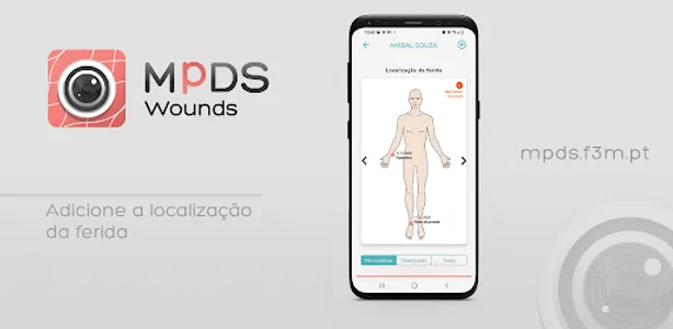 MpDS | Wounds screenshot 2