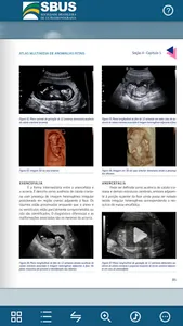 Atlas Multimídia de Anomalias screenshot 2