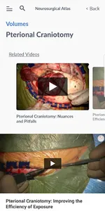 The Neurosurgical Atlas screenshot 4