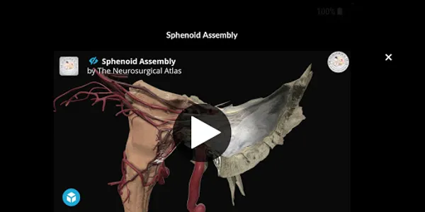 The Neurosurgical Atlas screenshot 5