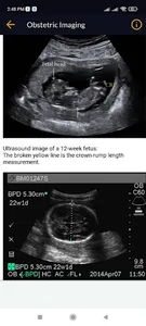 Obstetrics screenshot 1