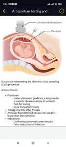 Obstetrics screenshot 6