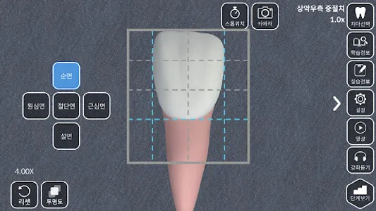 AR-D Morphology screenshot 6